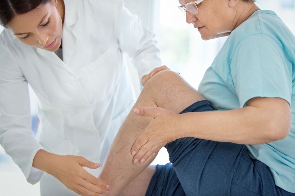 Aged women being examined by the doctor for varicose vein