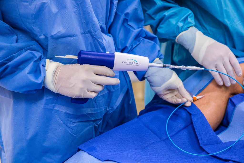Doctors performing Endovenous Ablation Therapy